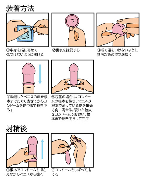 コンドームの裏表は