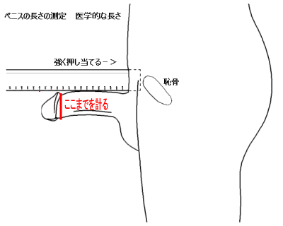 チントレ 負荷調整 ED改善 手動吸引 バキューム