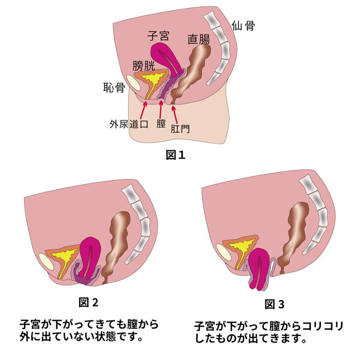 女性泌尿器科疾患 | 病診連携