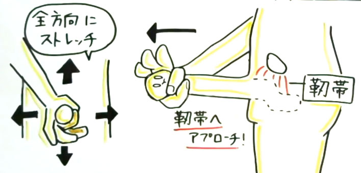 泌尿器科の医師が解説】亀頭を大きくする４つの方法を徹底検証