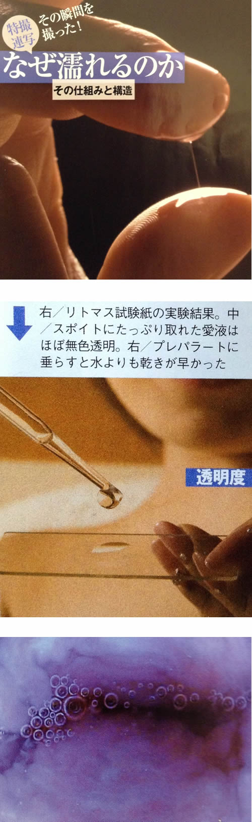 おりものに白い塊は病気のサイン？考えられる原因と対処法！病院を受診する目安も | 二宮レディースクリニック【泌尿器科・婦人科・アートメイク】