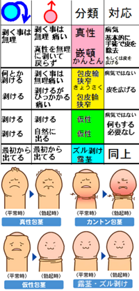 美容医療サービスにみる包茎手術の問題点(発表情報)_国民生活センター