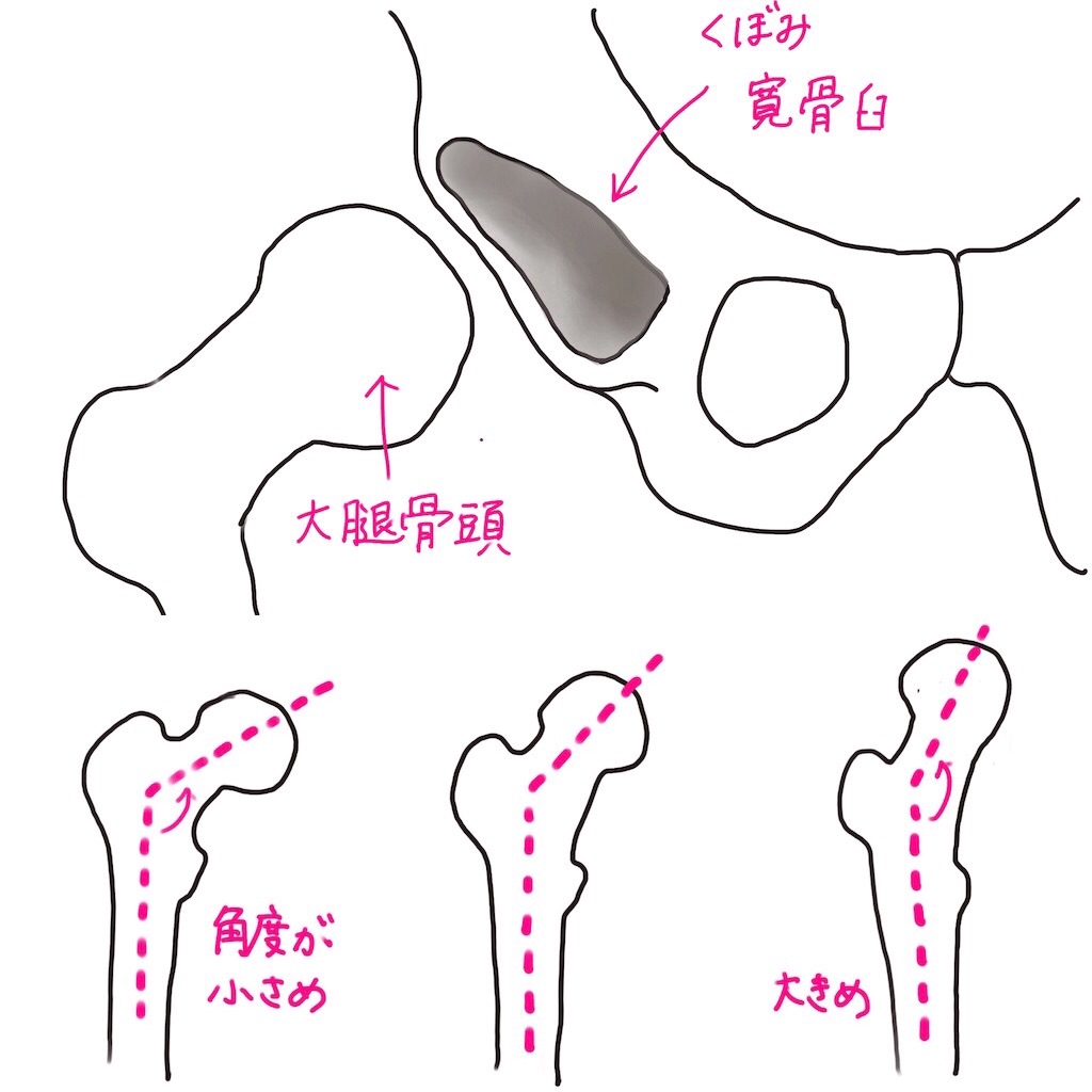 前屈して靴下を履くとき腰が痛むのは＜腰椎椎間板ヘルニア＞の可能性が｜医師おすすめの「仰向けもも裏のばし」で痛みの軽減を目指す (1/1)|  介護ポストセブン