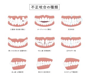 表情・しぐさで「ホンネを見抜く」テクニック【2】口の形 (2ページ目) |