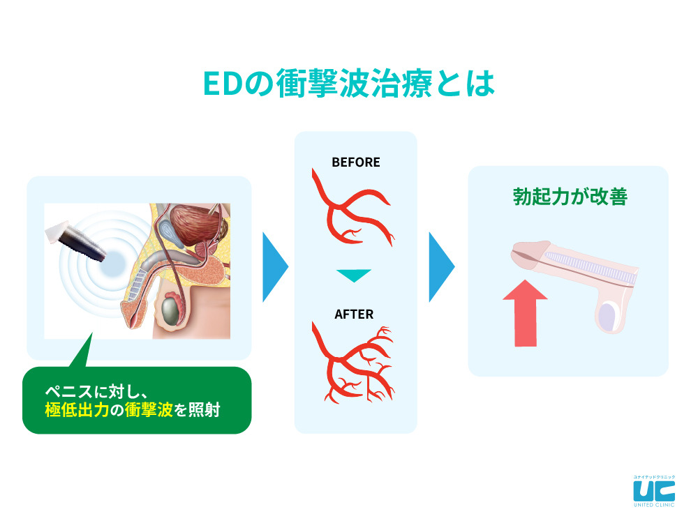 コックリングの効果と装着方法