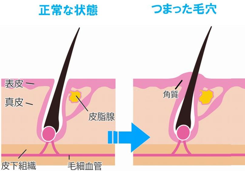 楽天市場】鼻 脂の通販