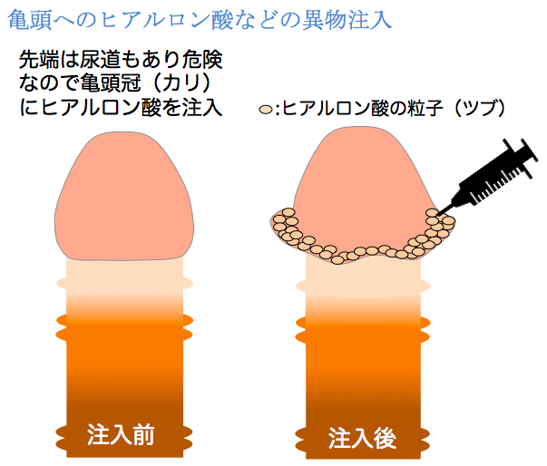 バキバキ】ちんこを硬くする6つの方法。自力で勃起力をアップさせる秘策｜あんしん通販コラム