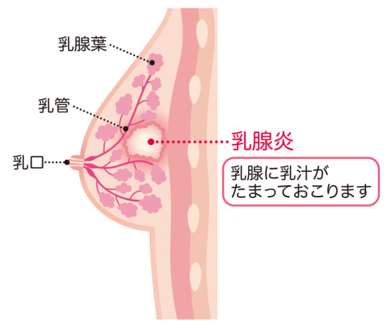 Pigeon 母乳実感【直付け】哺乳瓶用乳首 しょっぱい