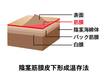 包茎｜神戸市東灘区 摂津本山｜いしむら腎泌尿器科クリニック