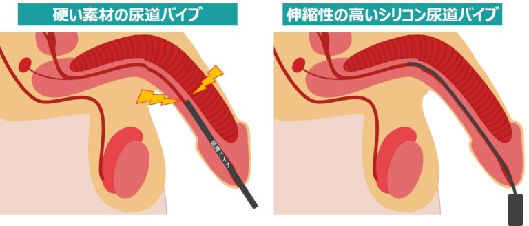 尿道オナニーで人生詰んだかもしれない話 - DLチャンネル みんなで作る二次元情報サイト！