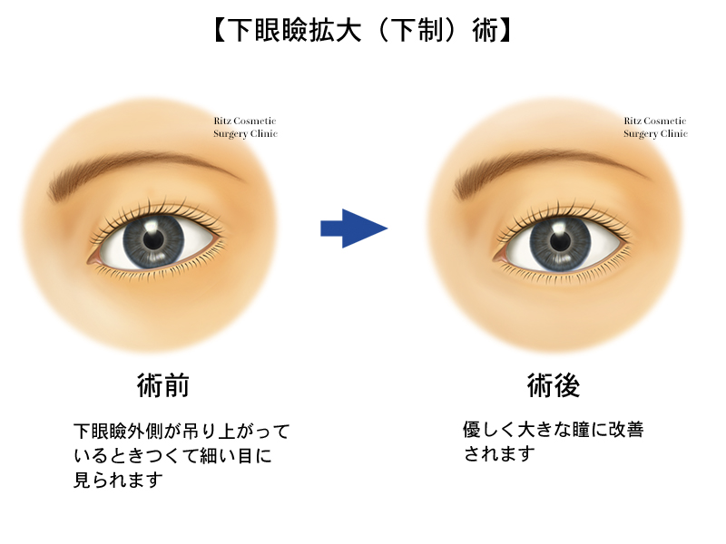 人の心，キツネの心（１）