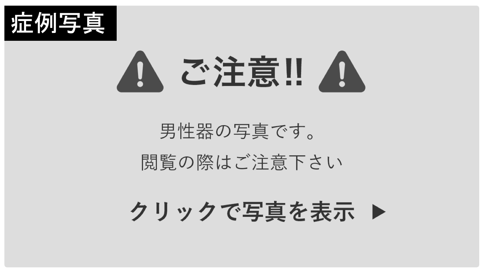 強○ヤクザ 野獣のように女を追い回し、服を引き裂いてトドメの一発は真珠入りペニスをぶち込む！！（CV:長竿蜜流）(KZentertainment) -  FANZA同人