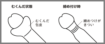 東京で包茎手術を受けるなら日暮里泌尿器科内科｜足立区・北区・文京区・台東区