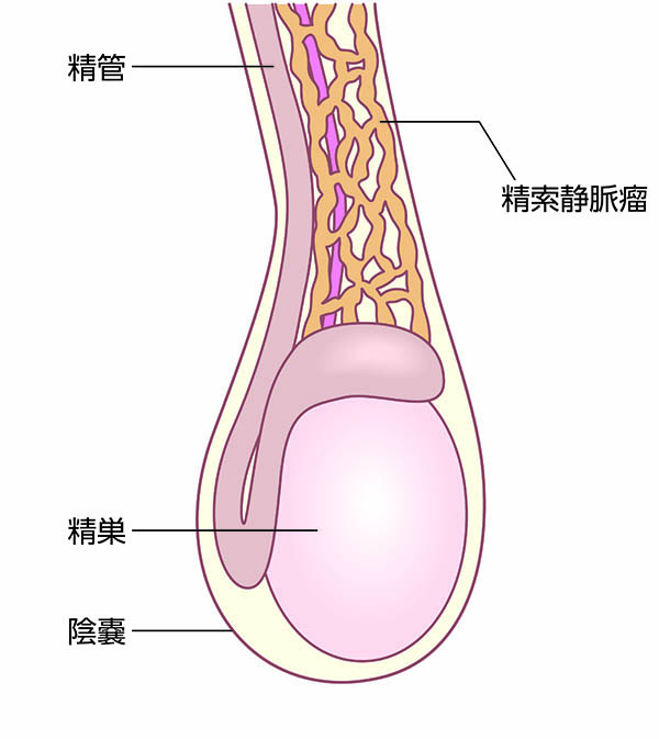 精巣上体炎について｜おき泌尿器科クリニック｜富田林市の泌尿器科