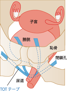 女性泌尿器｜自由が丘ウロケアクリニック｜女性医師が診る、目黒区自由が丘駅の女性泌尿器科・小児泌尿器科