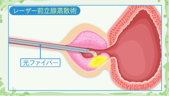 PYD1102☆ 前立腺 マブレーター 手にもって弄れるッサージ バイ！