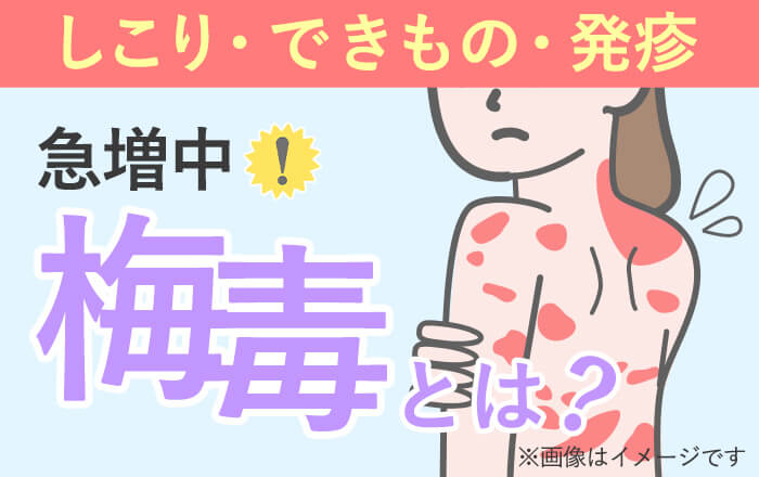 水張り」のやり方 もう失敗しない！手順と必要な道具を解説