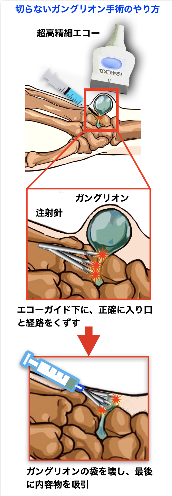 ふるさと納税とは？仕組み・メリットと初心者も安心なやり方｜りそなグループ