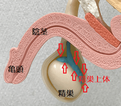 睾丸摘出手術/陰嚢切除/偽睾丸挿入 | 大阪市天王寺区上本町のノリス美容クリニック