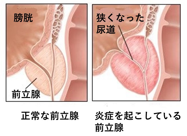 金玉の痛み・腫れの原因はストレス？病気？｜小田泌尿器科