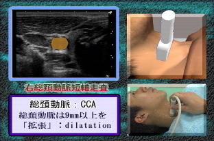 下垂体腫瘍｜日本医科大学武蔵小杉病院