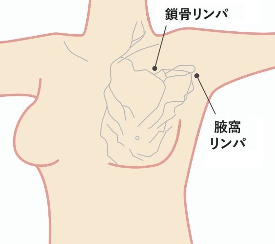 楽天市場】バストアップ ems バストケア