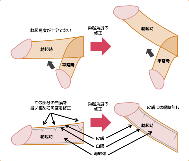 女性に好かれる上反りペニスとは？上向きペニスとの違いやトレーニング方法など | ザヘルプM