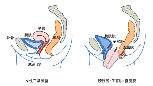 【実はお水で洗うと失敗する】膣内は〇〇で洗う！正しい膣の状態やケアを解説！