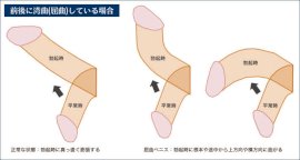 あなたは反りチン？上反り・下反りのメリットや女性の意見を紹介！｜駅ちか！風俗雑記帳