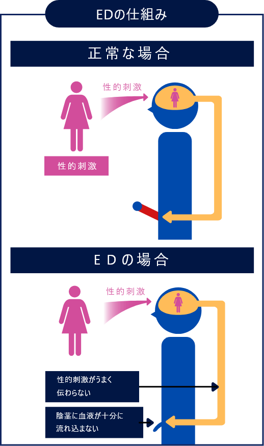 オナニー（自慰行為）のしすぎでEDになる？適切な頻度や毎日するリスクを紹介 |【公式】ユナイテッドクリニック