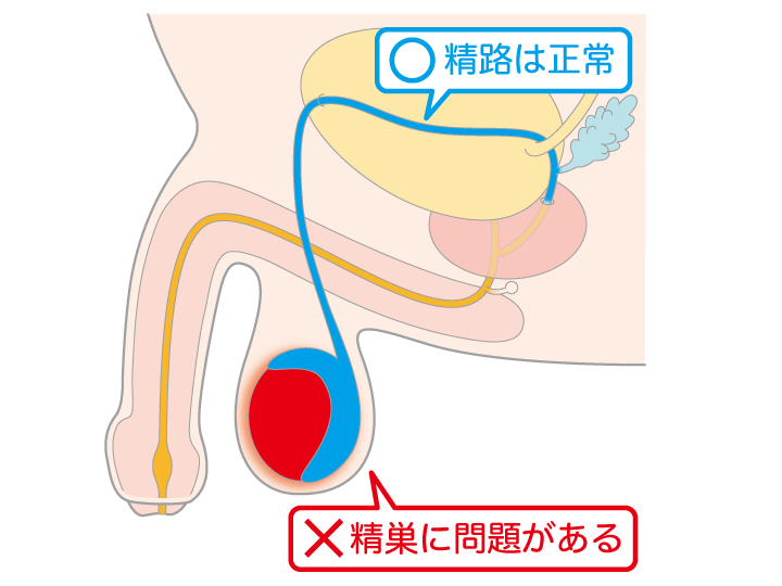 夢の中で射精することがあるのです。たまに。 そしたら、夢精してるの- その他（性の悩み）