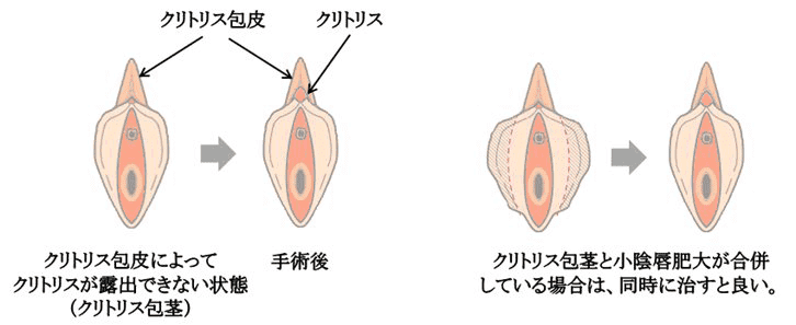 Amazon | バイブ クリトリス