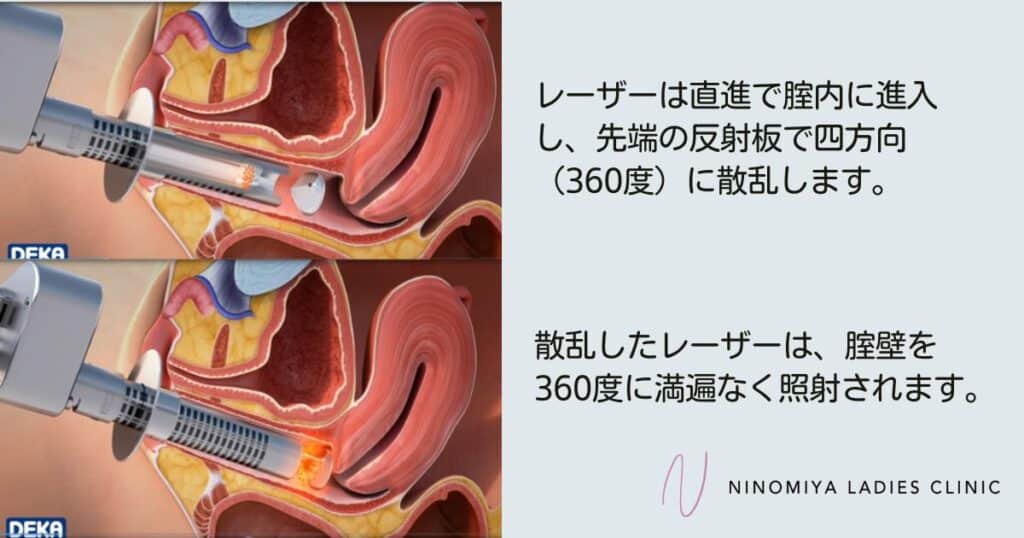 膀胱炎って?療養・予防のポイントは? | みんなのクリニック大井町