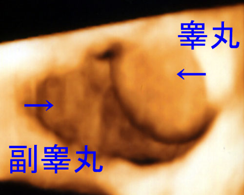 睾丸・キンタマが痛い（精巣の痛み）｜川崎市麻生区のもちづき泌尿器科クリニック｜柿生駅徒歩1分