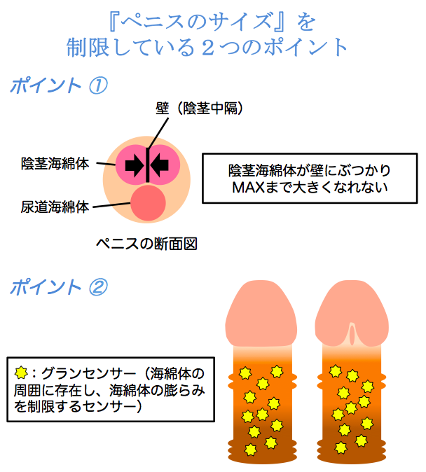 長茎術（パワーアップ） ： 男性器（包茎、長茎など）：美容外科