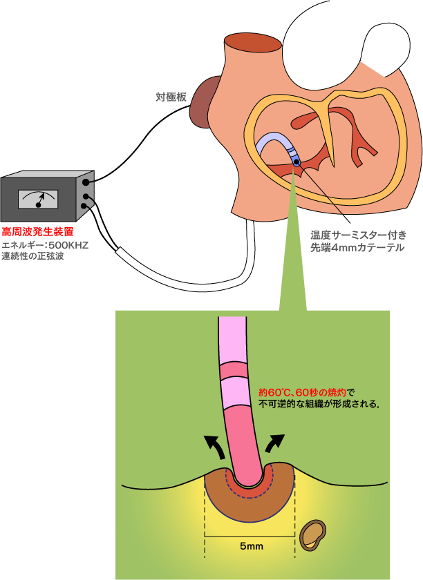 像面位相差ＡＦ（オートフォーカス）の原理