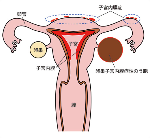 自動修復を準備しています】進まない・長い・画面が真っ暗になる原因と対処法！Windows10/11 | リネットジャパン通信