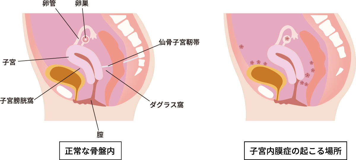 足ピンオナニーは危険って本当？やめたいときの改善方法も紹介 |【公式】ユナイテッドクリニック