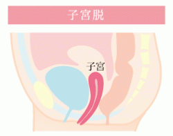 Gスポットがない」「どこにあるのか場所がわからない」感じる位置の探し方 | 【きもイク】気持ちよくイクカラダ