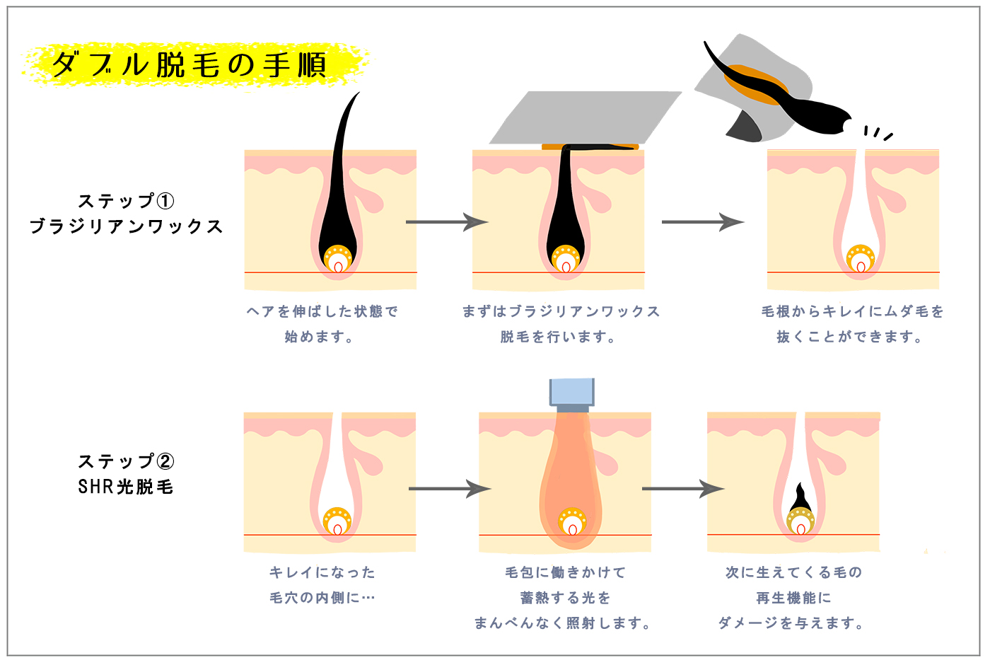 毛抜きでヒゲを抜くと生えなくなる？｜髭の自己処理方法の比較とヒゲをなくす方法 | エピステ