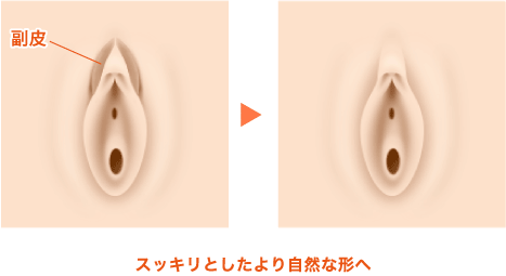 クリトリスは快感を得るための臓器であることを知っていましたか？