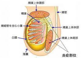 遅れた射精による睾丸の痛み, 青いボールの5つの症状を認識