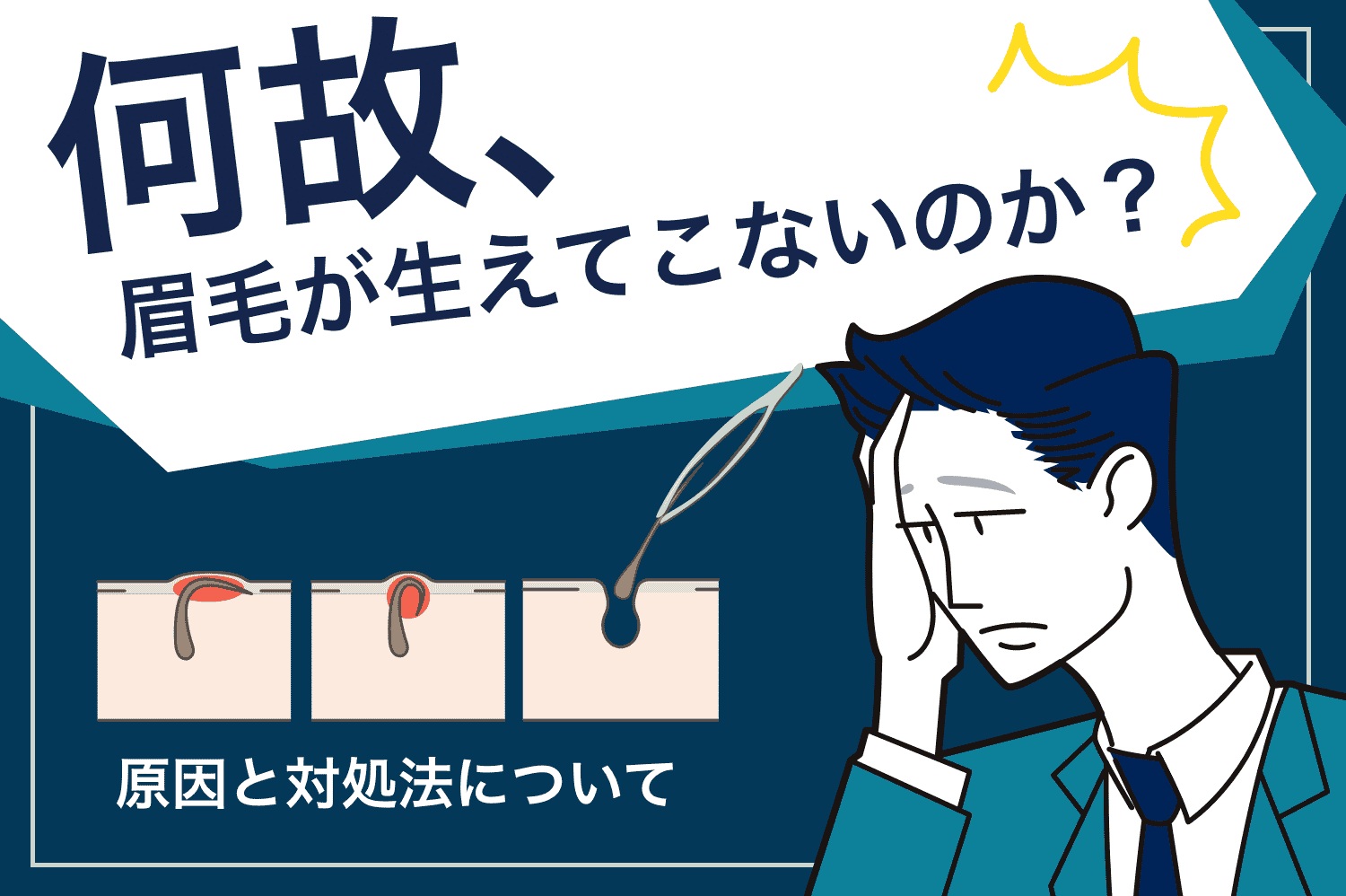 毛を抜く」自己処理はNG！脱毛中にムダ毛をなくす正しい処理方法 | メンズ脱毛百科事典 リンクスペディア