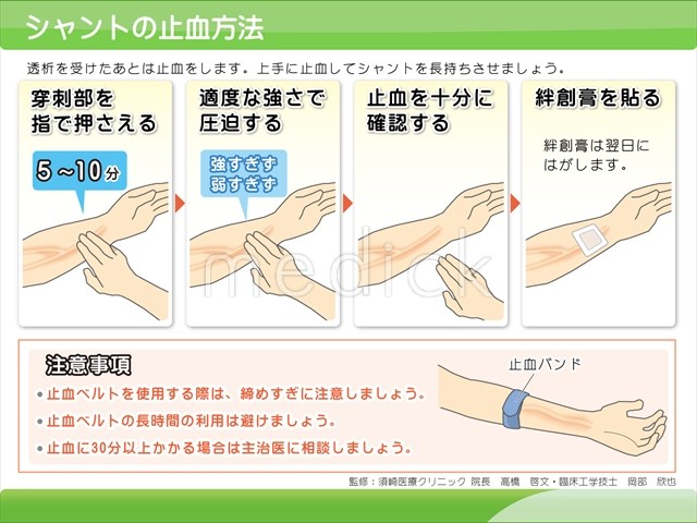 脳血管性認知症ー予防と治療ー | 脳疾患を知る