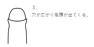 医師監修】包茎が原因で引きおこる痛みとは？ | メンズライフクリニック【公式】